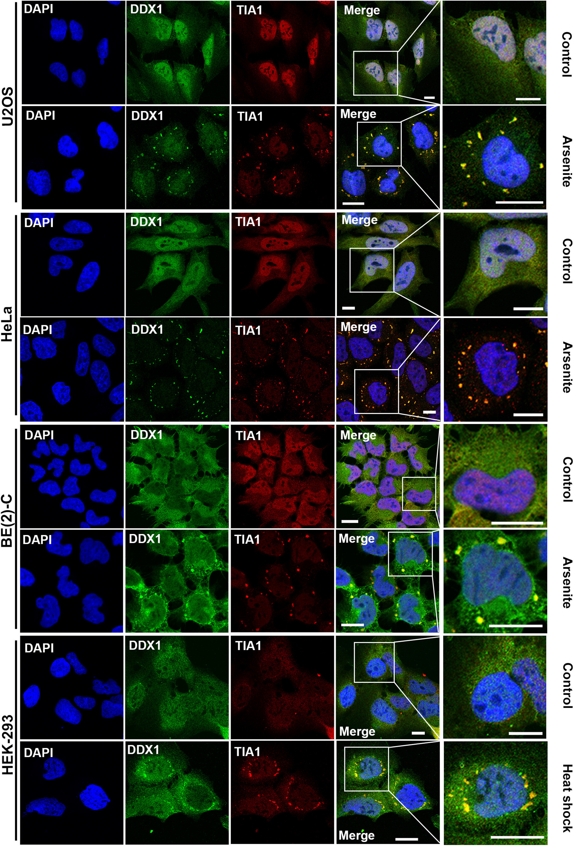 Journal of Biological Chemistry 2022 - DDX1 Stress Response
