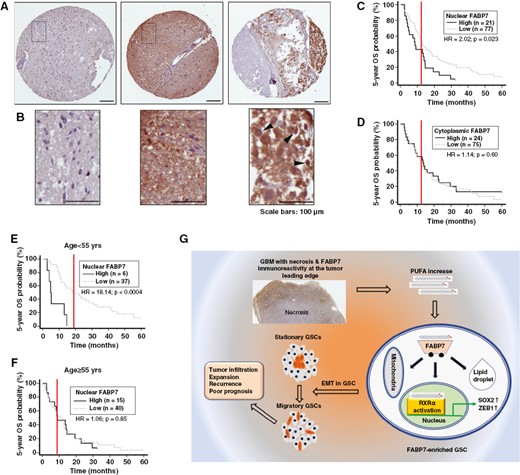 Neuro-Oncology 2023 - FABP7-RXRα Pathway
