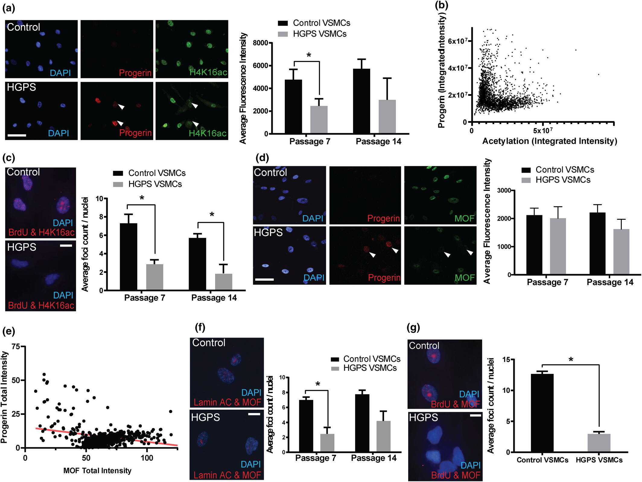 Aging Cell 2024 - Vascular Aging in Progeria