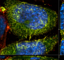 GFP-labeled cellular structures