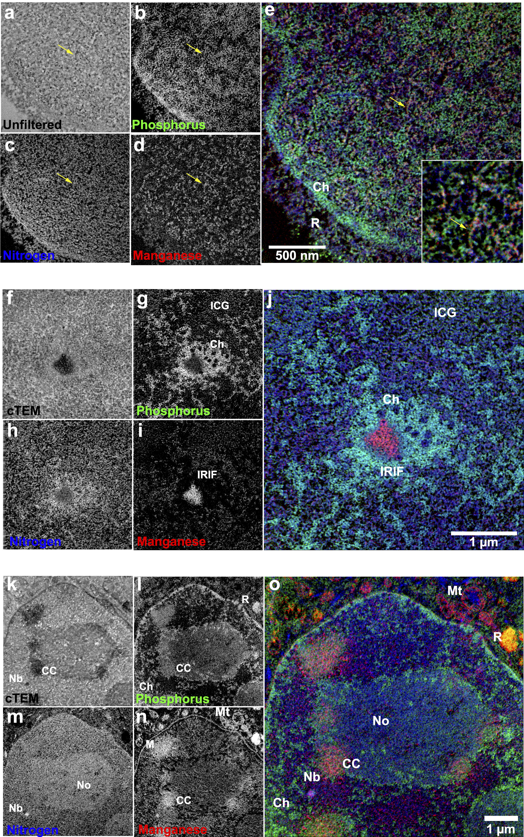 Microscopy 2023 - Multichannel EM